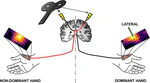 Lateralized asymmetries in distribution of muscular evoked responses: An evidence of specialized motor control over an intrinsic hand muscle